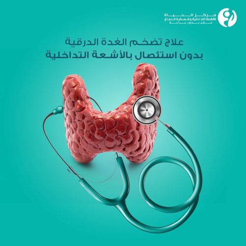 علاج تضخم الغدة الدرقية بدون جراحة